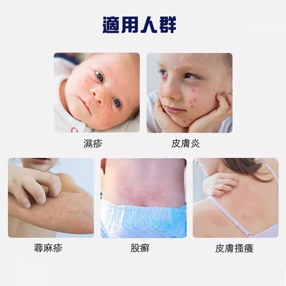 【日本境內】濕疹VG軟膏