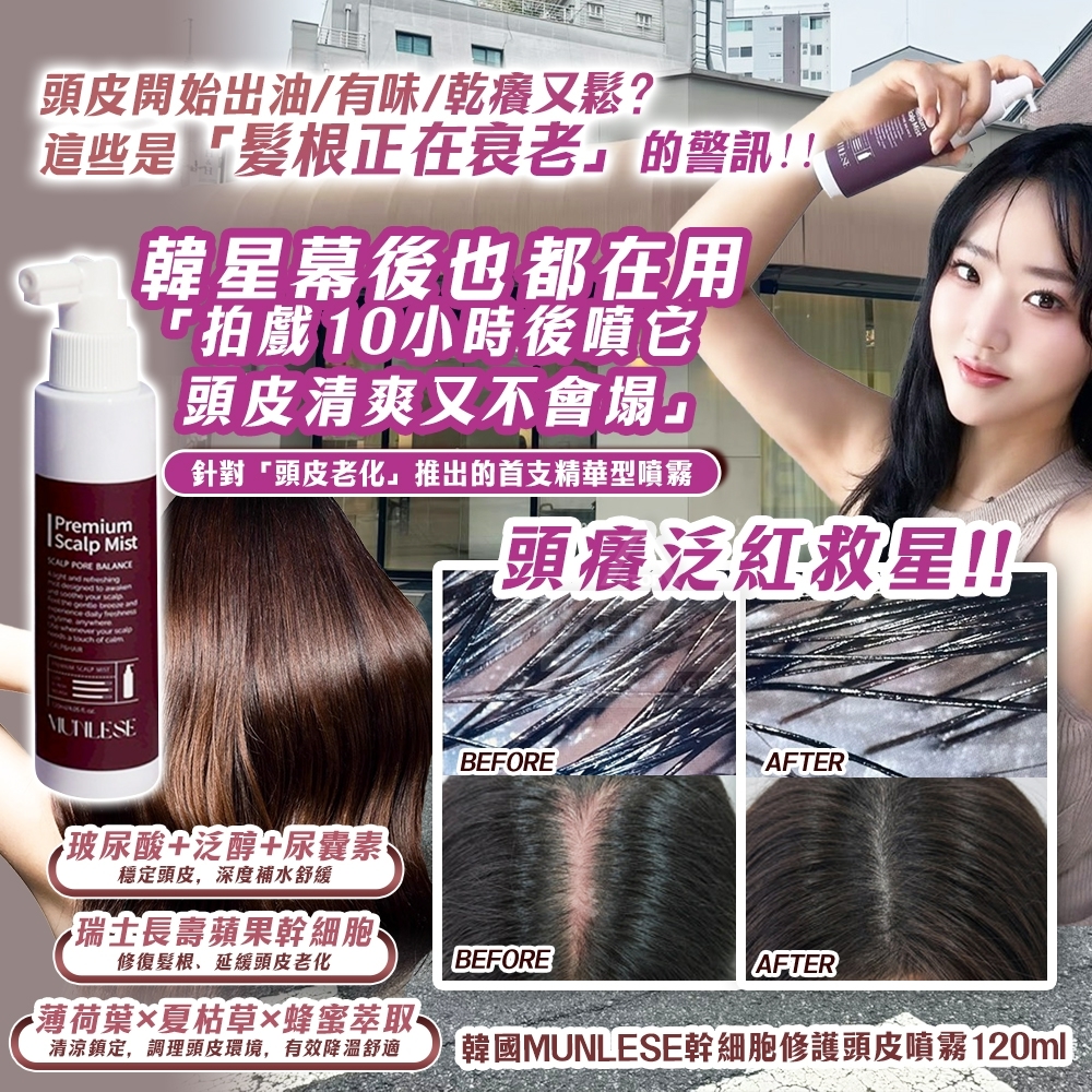 WSBB10375  韓國製造🇰🇷｜MUNLESE 修護頭皮噴霧｜頭皮逆齡從髮根開始｜120ml（現貨）