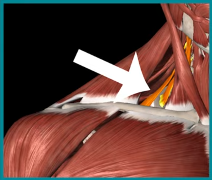 斜角肌位置示意圖