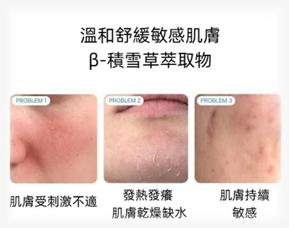 (Q1) β-谷甾醇舒緩霜 (50ml) (第二件$120) - Carenology #CA17