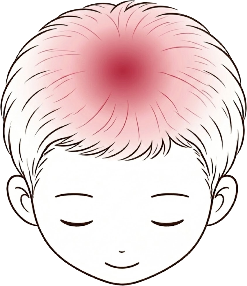 頭頂（髮旋區）稀疏