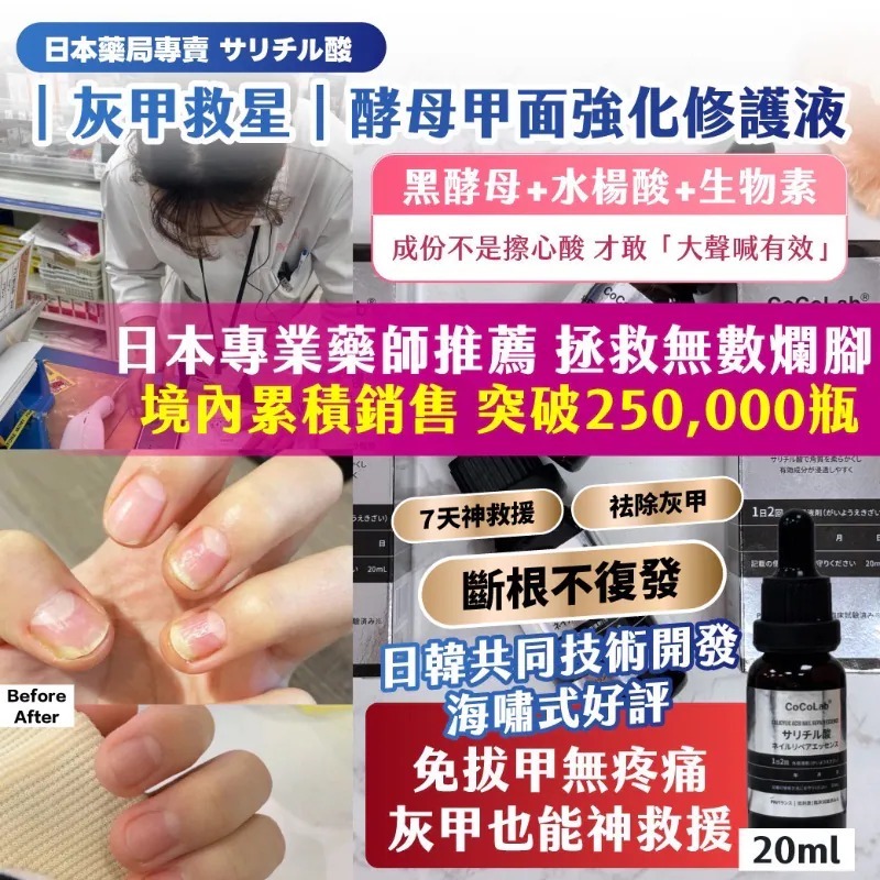 WSBB9398   日本藥局專賣 サリチル酸 ｜灰甲救星｜酵母甲面強化修護液20ml（現貨）