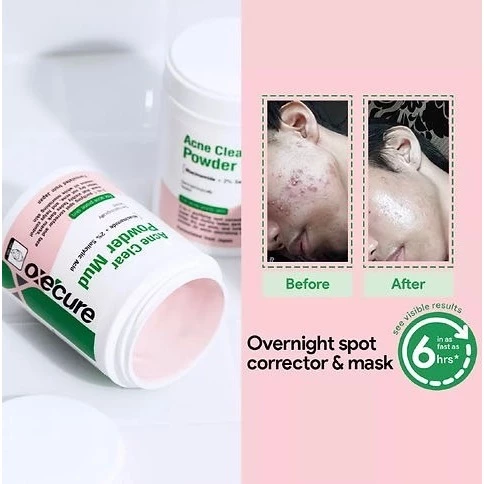Oxecure Acne Clear Powder Mud 抗痘淨膚泥膜 50g