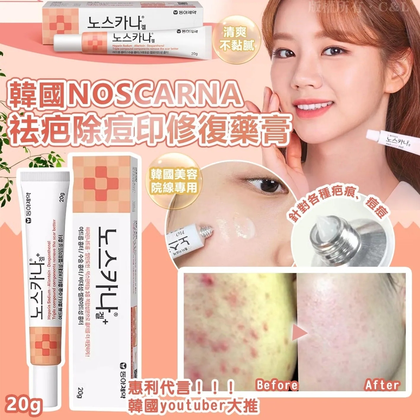 【直播】韓國東亞製藥 LX0414224 強效祛疤除痘印修復膏 20g