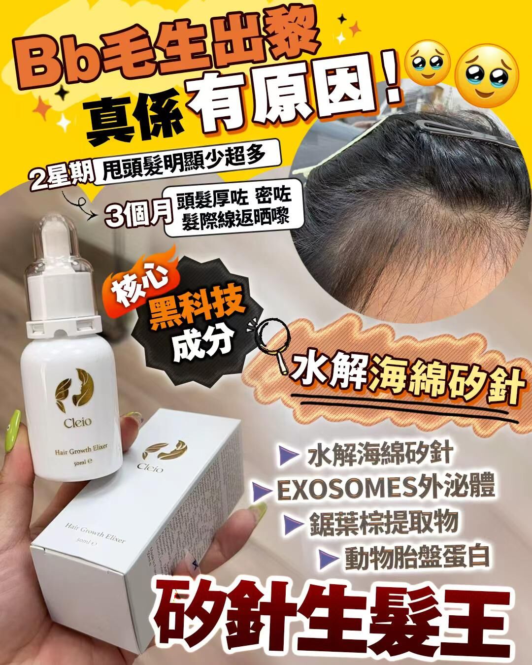 💥外泌體矽針生髮王 50ml