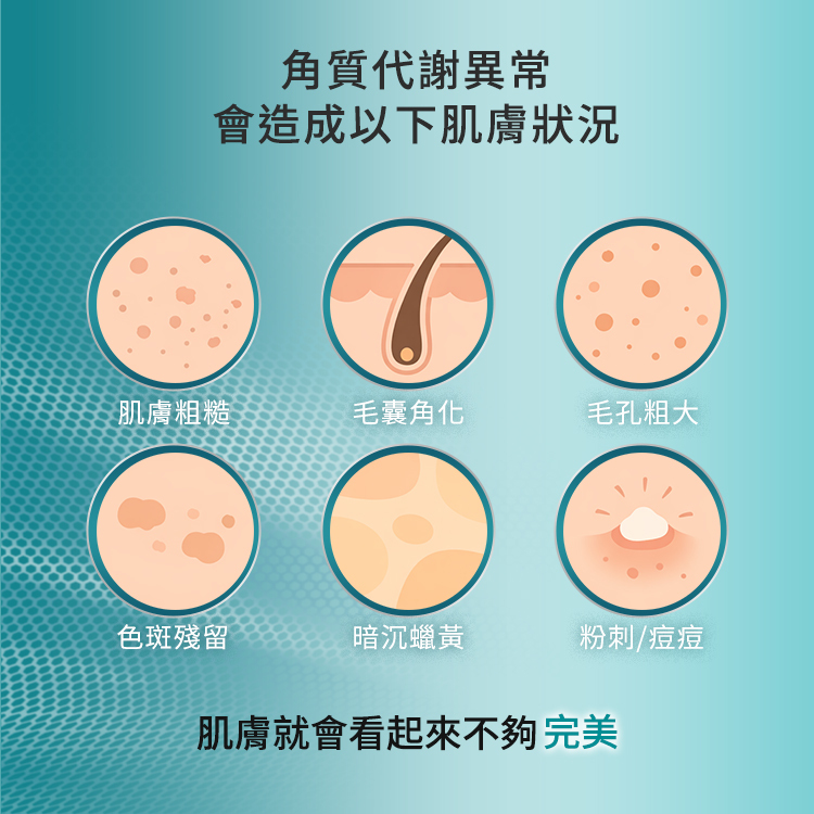 角質代謝異常會造成的六大肌膚狀況，包含肌膚粗糙、毛囊角化、毛孔粗大、色斑殘留、暗沉蠟黃以及粉刺痘痘，這些問題會讓肌膚看起來不夠完美。