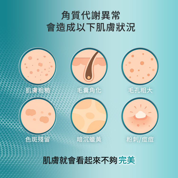 角質代謝異常會引發的六大肌膚困擾，包括肌膚粗糙、毛囊角化、毛孔粗大、色斑殘留、暗沉蠟黃以及粉刺與痘痘問題，說明當角質層失序時，肌膚整體視覺會顯得不夠完美。