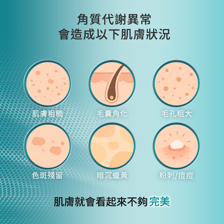 角質代謝異常會引發的六大肌膚困擾，包括肌膚粗糙、毛囊角化、毛孔粗大、色斑殘留、暗沉蠟黃以及粉刺與痘痘問題。這些狀況會讓肌膚視覺上顯得不夠完美，需要透過針對性的保養來解決角質絮亂。