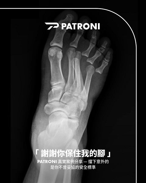顧客實際分享穿著PATRONI安全鞋後保住右腳免於骨折、截肢等嚴重傷害的故事，圖為右腳X光照