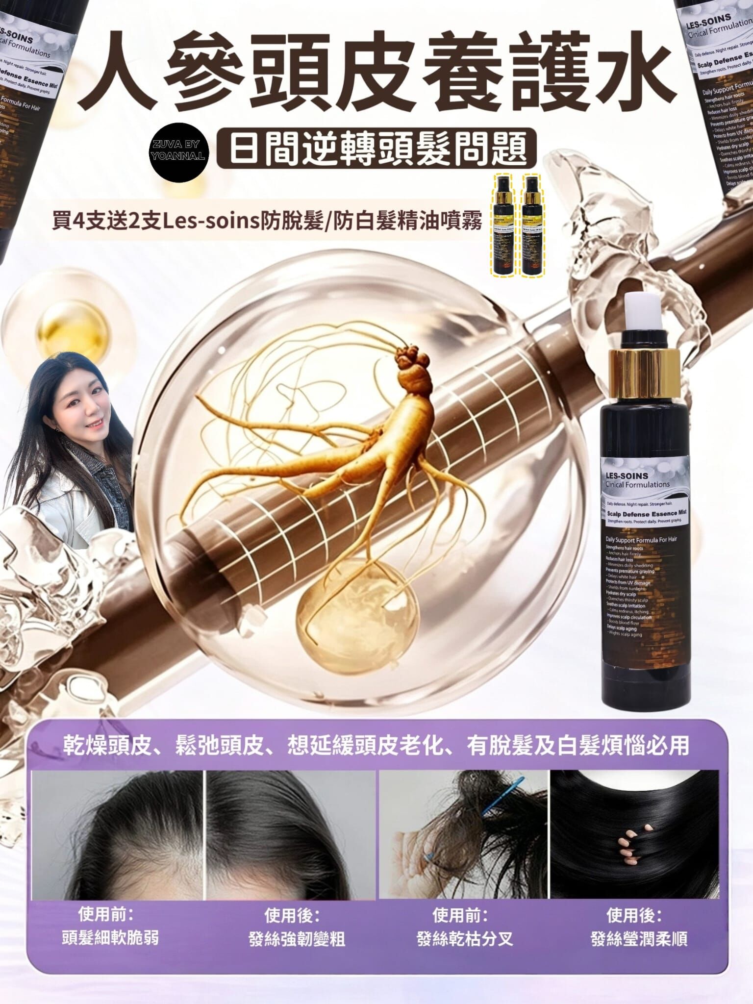 （日間逆轉頭髮問題）Les-soins 人參頭皮養護水100ml T173｜日間用・一噴防護】