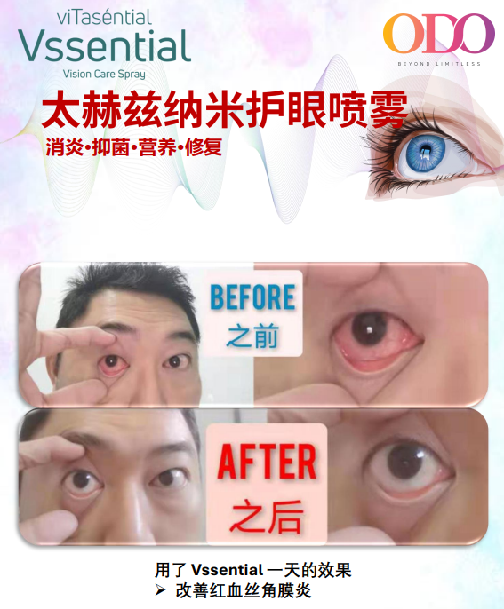 NB08 Vssential 納米護眼噴霧 15ml X6 支   $1280