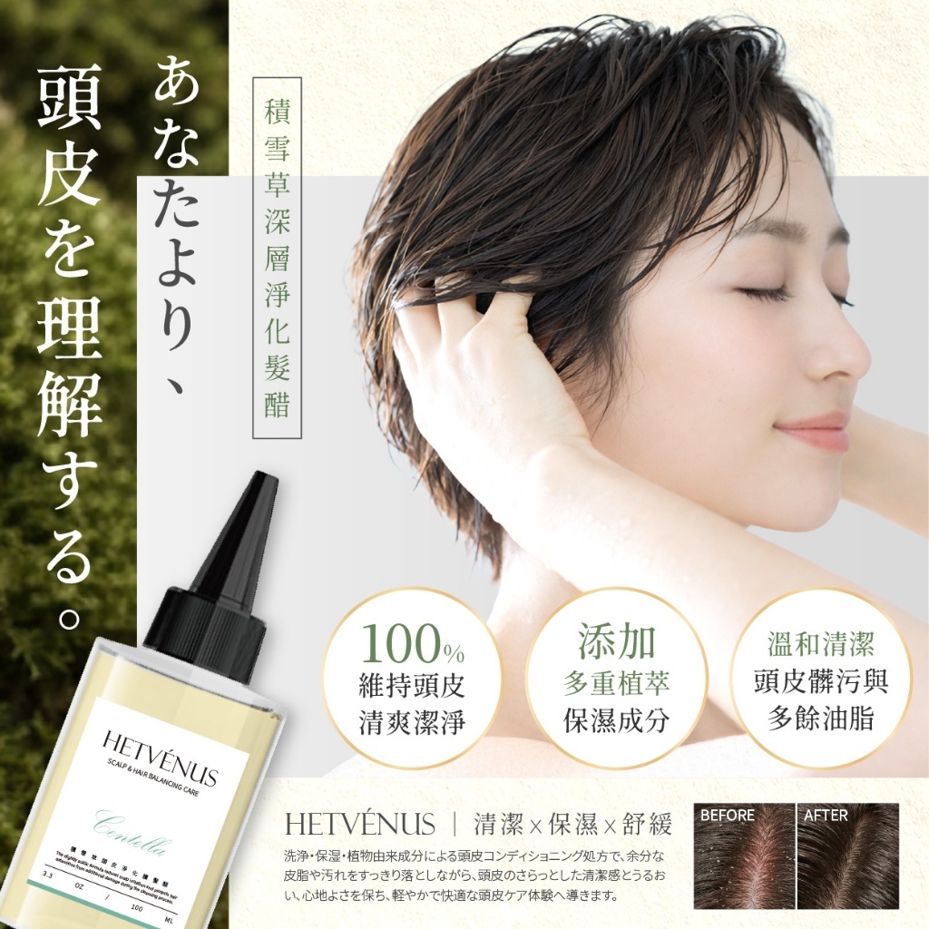 WSBB11281 HETVÉNUS® 積雪草頭皮深層淨化護髮醋(需沖洗) 100ml（7月上旬 ）