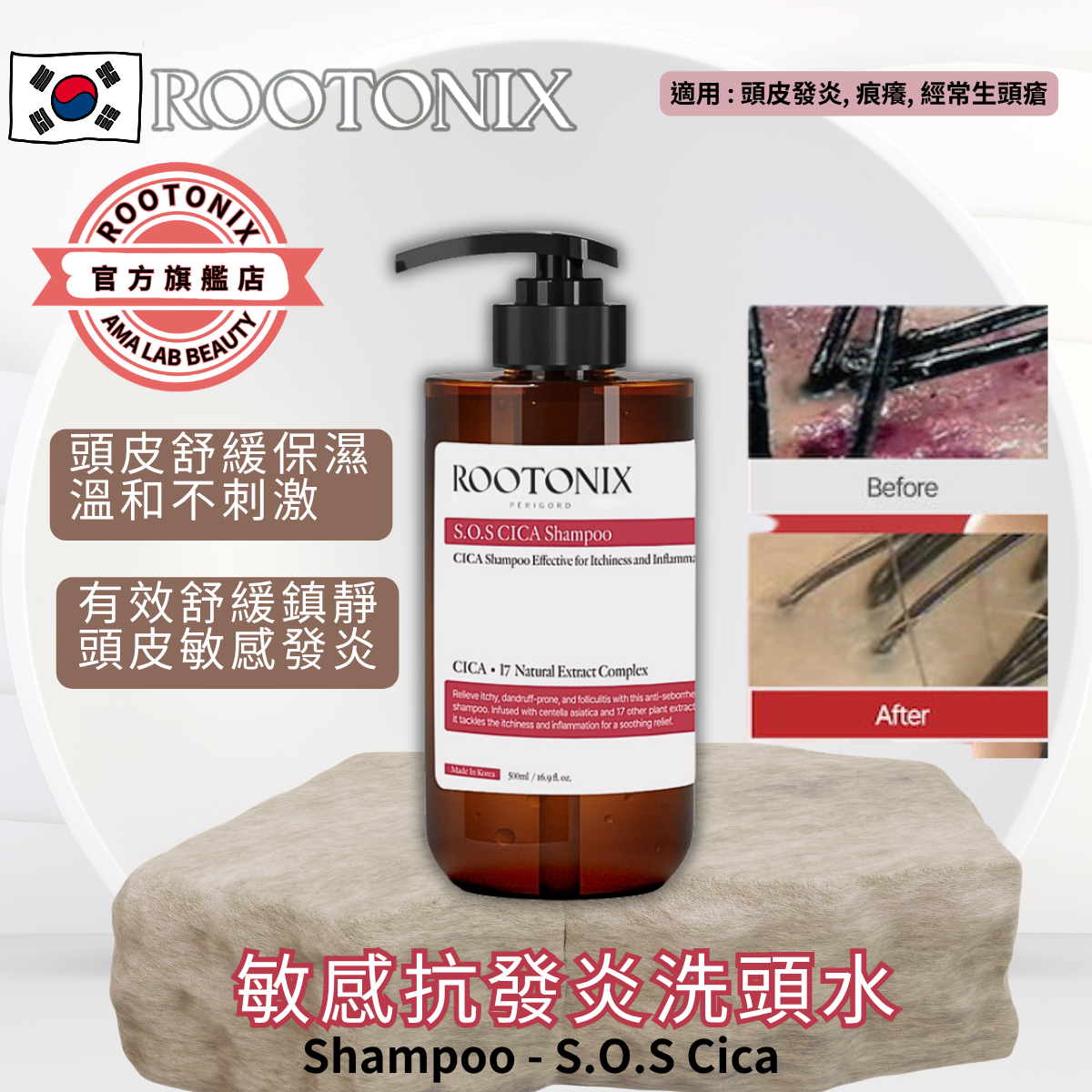 韓國 ROOTONIX 急救敏感抗發炎頭皮洗頭水 S.O.S Inflammatory Scalp Shampoo 500ml