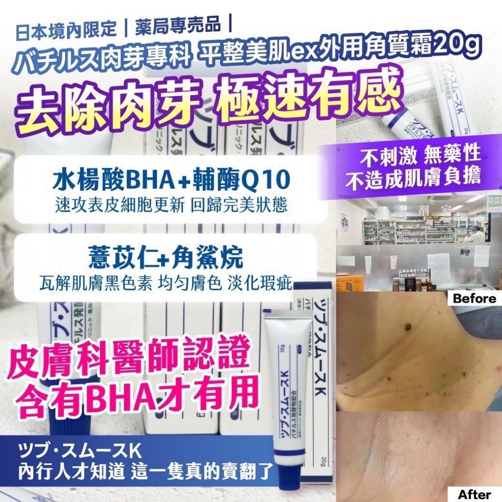 WSBB10255 丨🇯🇵日本境內限定｜薬局専売品｜バチルス肉芽專科 平整美肌ex外用角質霜20g （6月底 ）