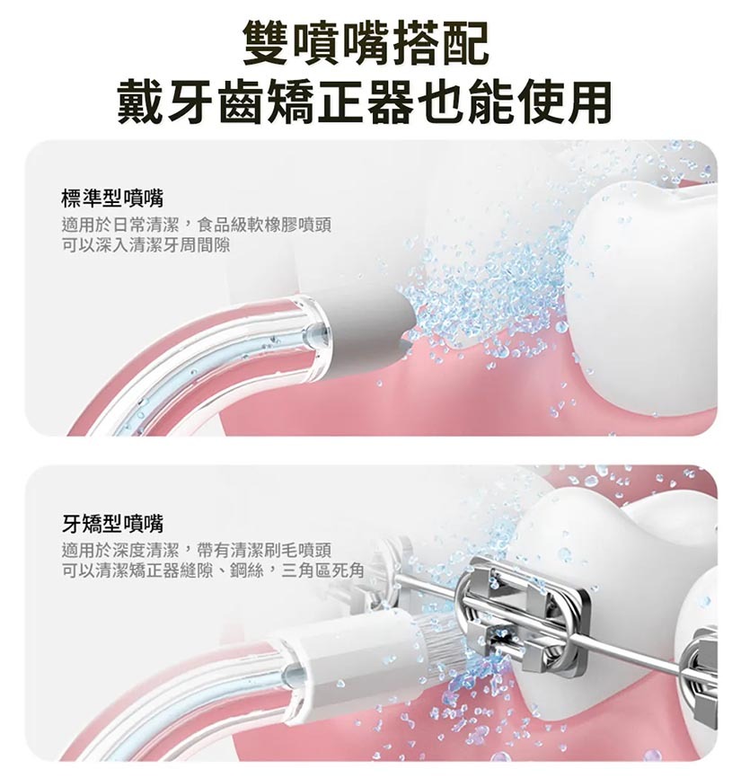Oclean A10 活氧氣動沖牙機-兩種噴嘴搭配 戴牙套也能使用