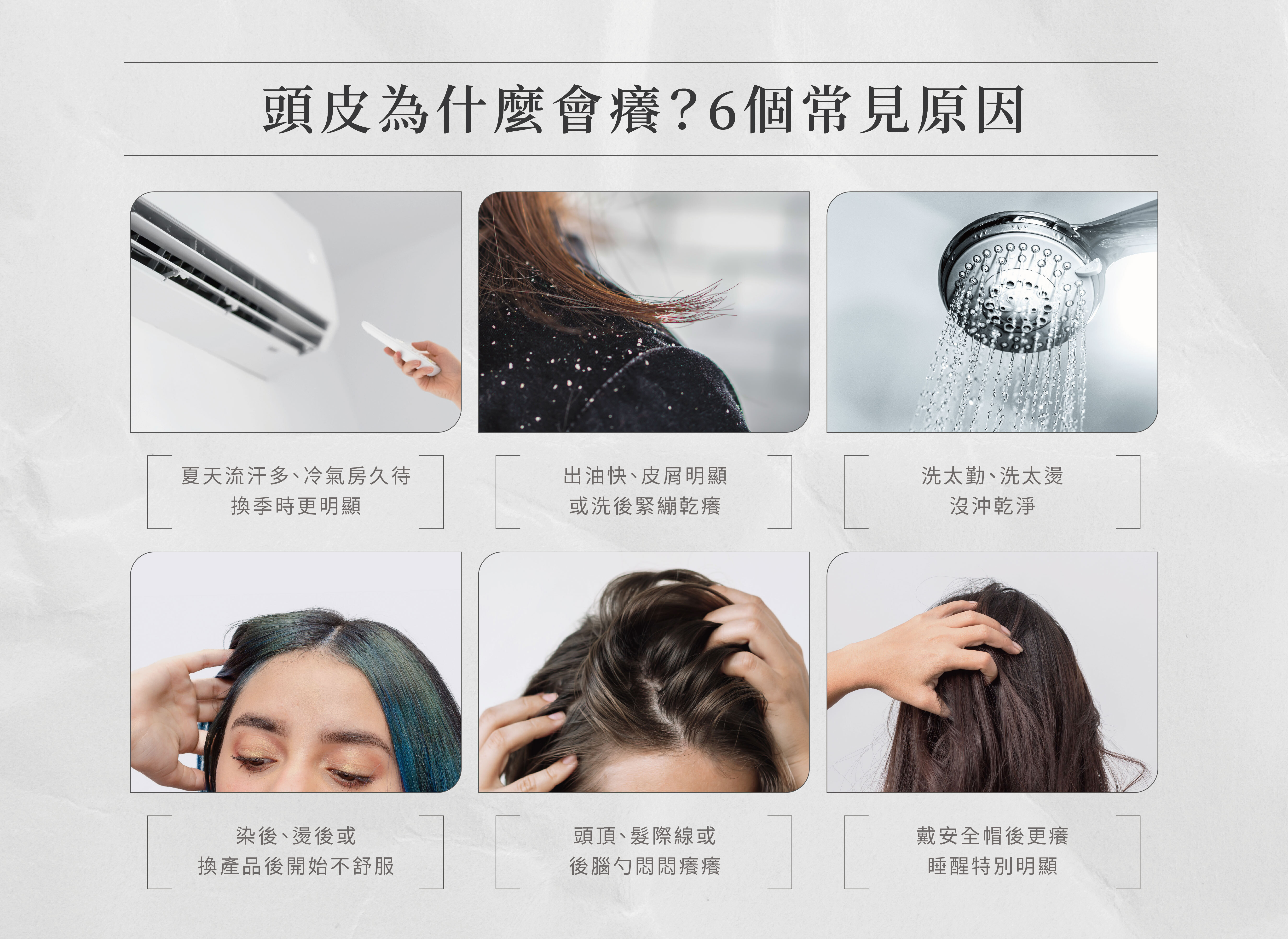 6 個頭皮癢常見原因