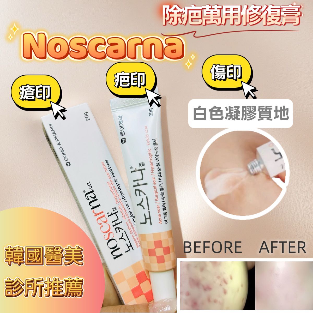 Noscarna韓國超強修復淡疤膏