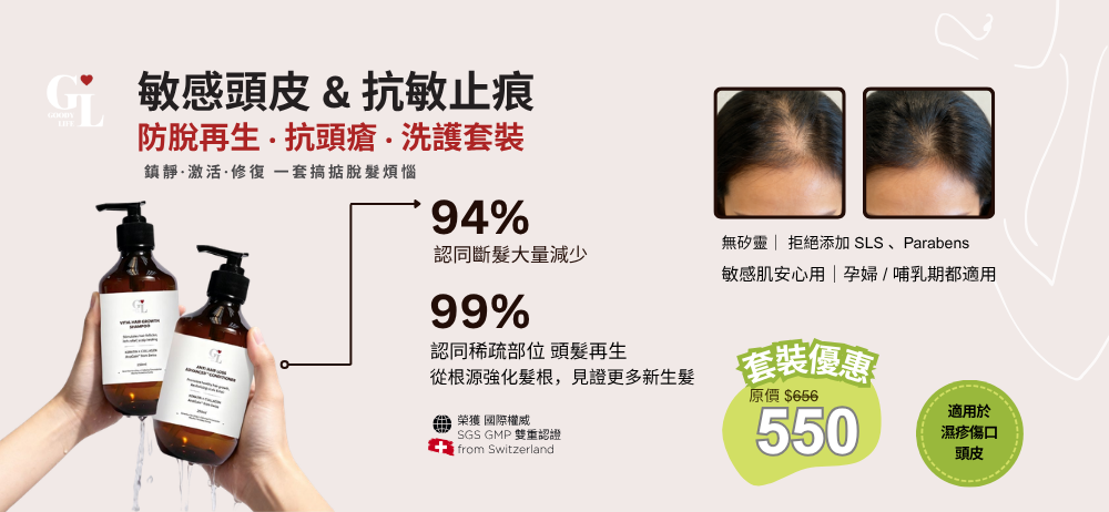 GL 洗頭水，專為敏感發炎頭皮設計的天然配方