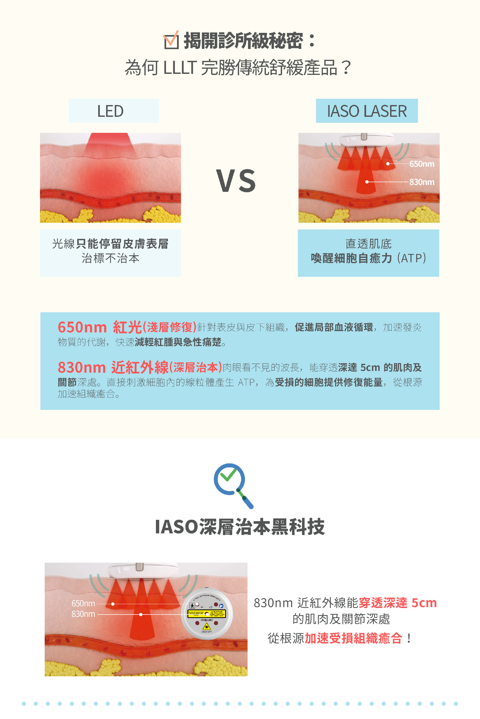 國際物理治療師及專業脊醫強烈推薦 IASO 醫療級冷激光儀