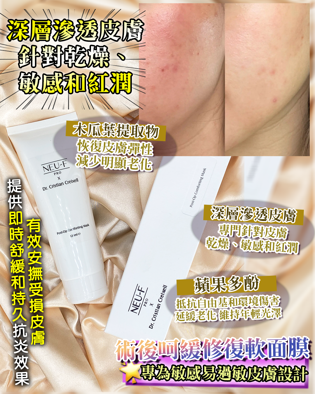 🇫🇷 法國護膚美學直擊 - Neu-F Pro x Dr Cristian Creixell Post - Op Comforting Mask 送 Hydro Light Boost mask 2片（貨期兩個月）