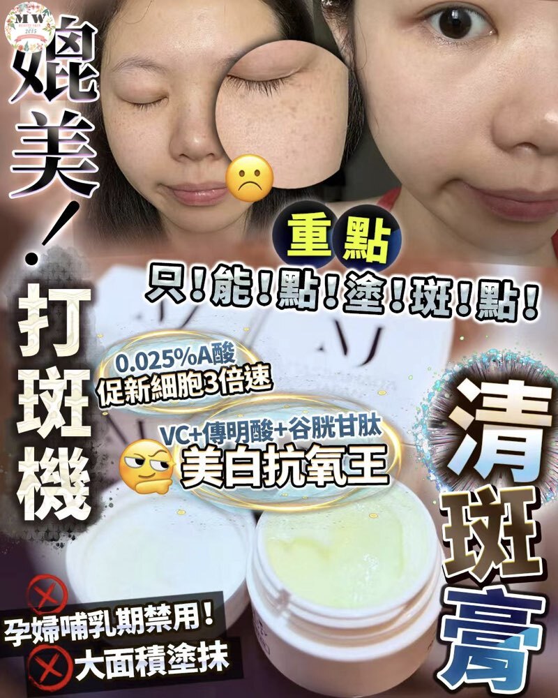 清斑膏 15g  重點塗抹
