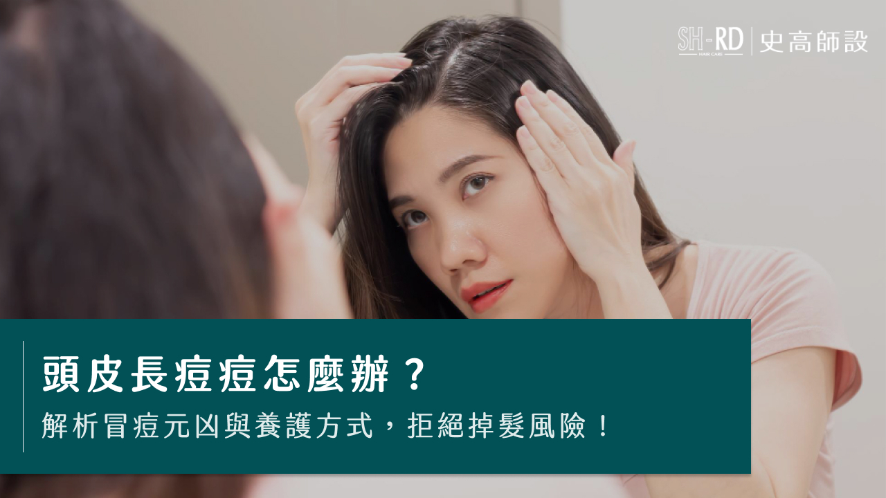 頭皮長痘痘怎麼辦？解析冒痘元凶與養護方式，拒絕掉髮風險！