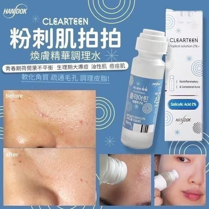 HANDOK Clearteen 韓國國民去痘痘水30ml