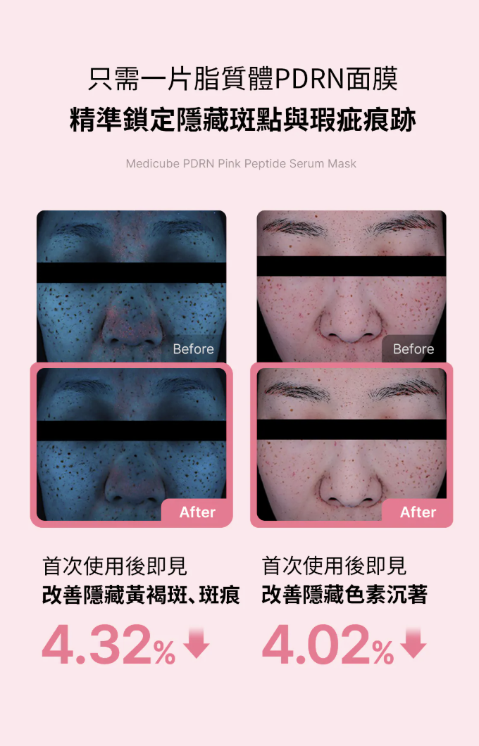 0516MD16-KOREATRIP-BEAUTY-MEDICUBE **PDRN 粉紅胜肽膠原安瓶面膜6片（A16）