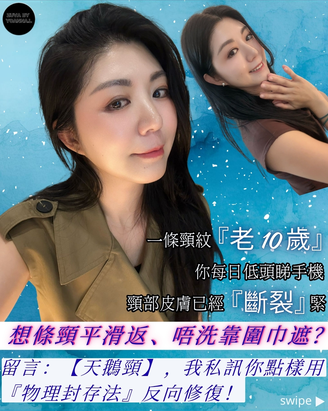 頸紋