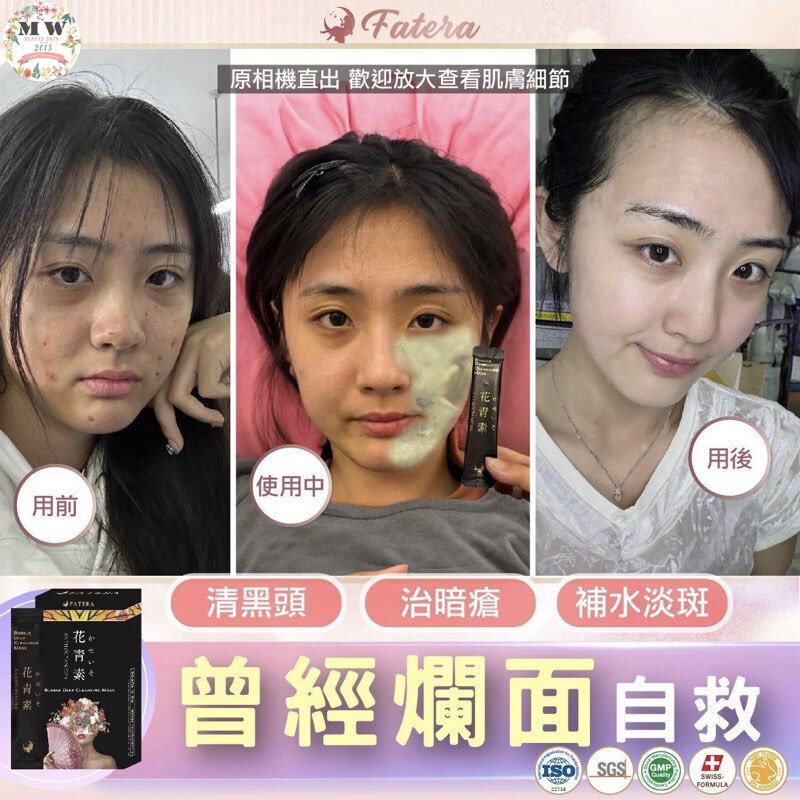 𝐅𝐚𝐭𝐞𝐫𝐚 花青素面膜