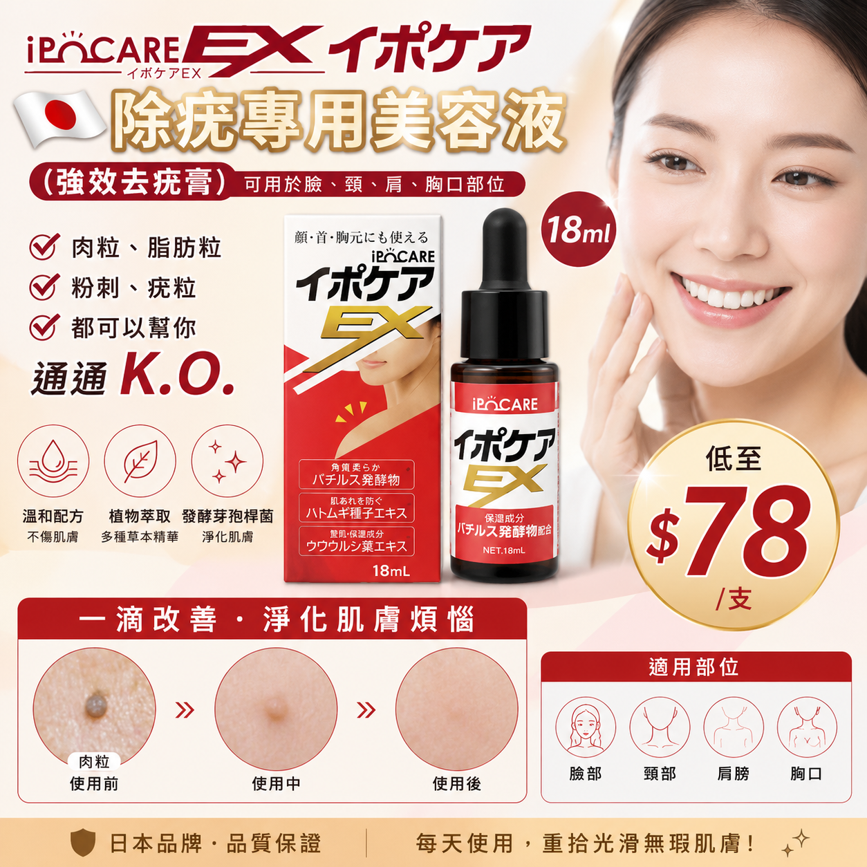 【UB9455】日本IPOCARE除疣專用美容液 18ml (新版)