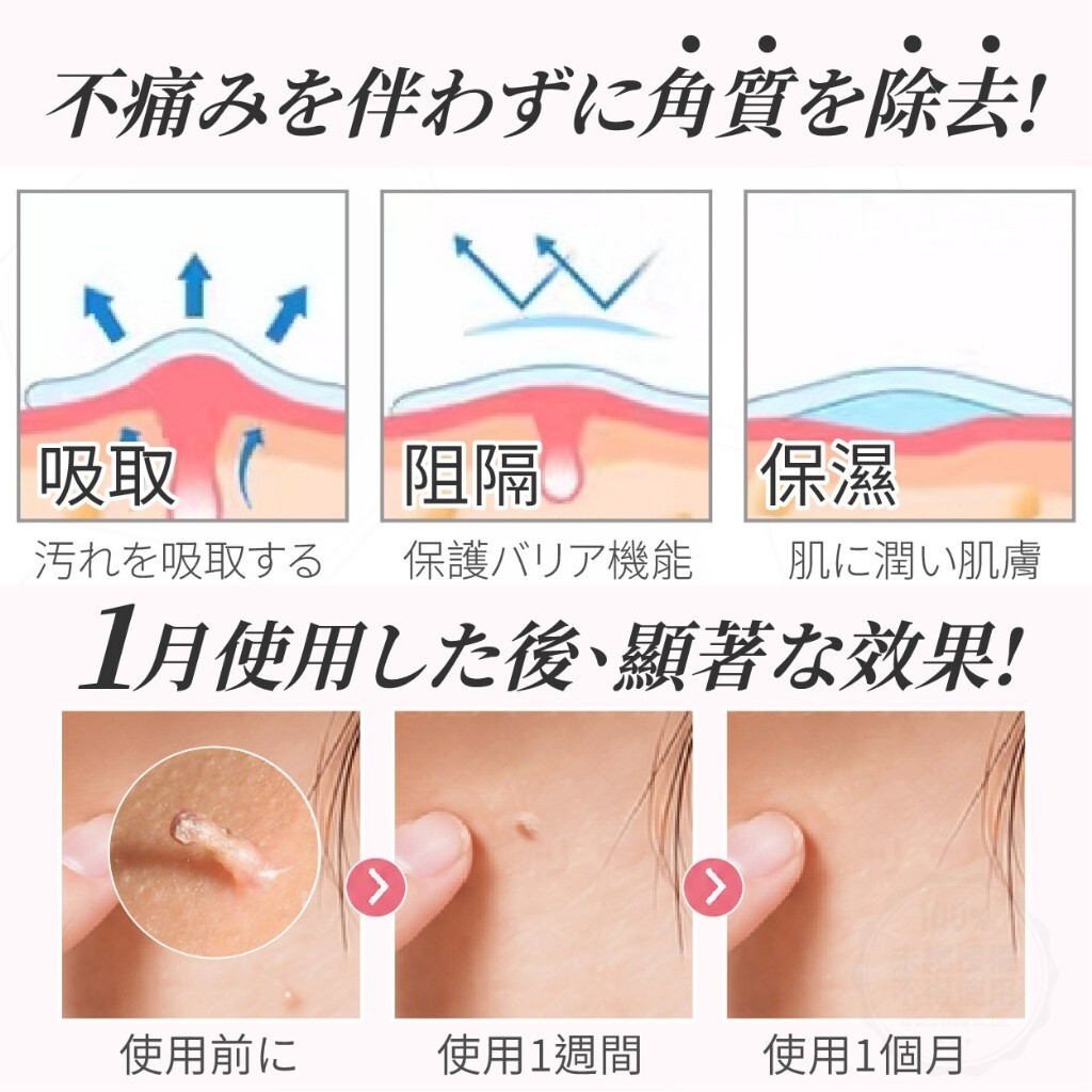 WSBB11621  Medimetry®醫美仿生雷射平整肉芽貼 (180貼/盒)（7月底）