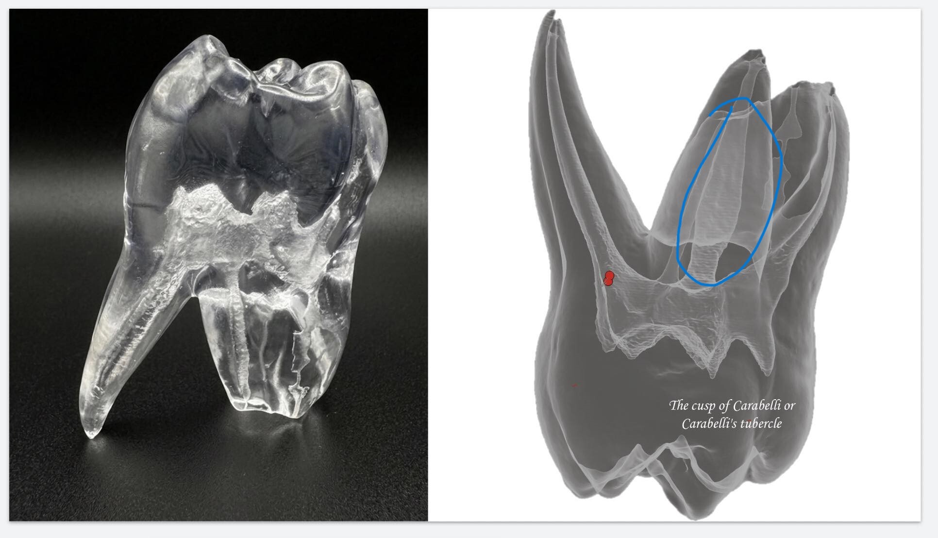 上顎第一大臼齒 Micro-CT 3D列印