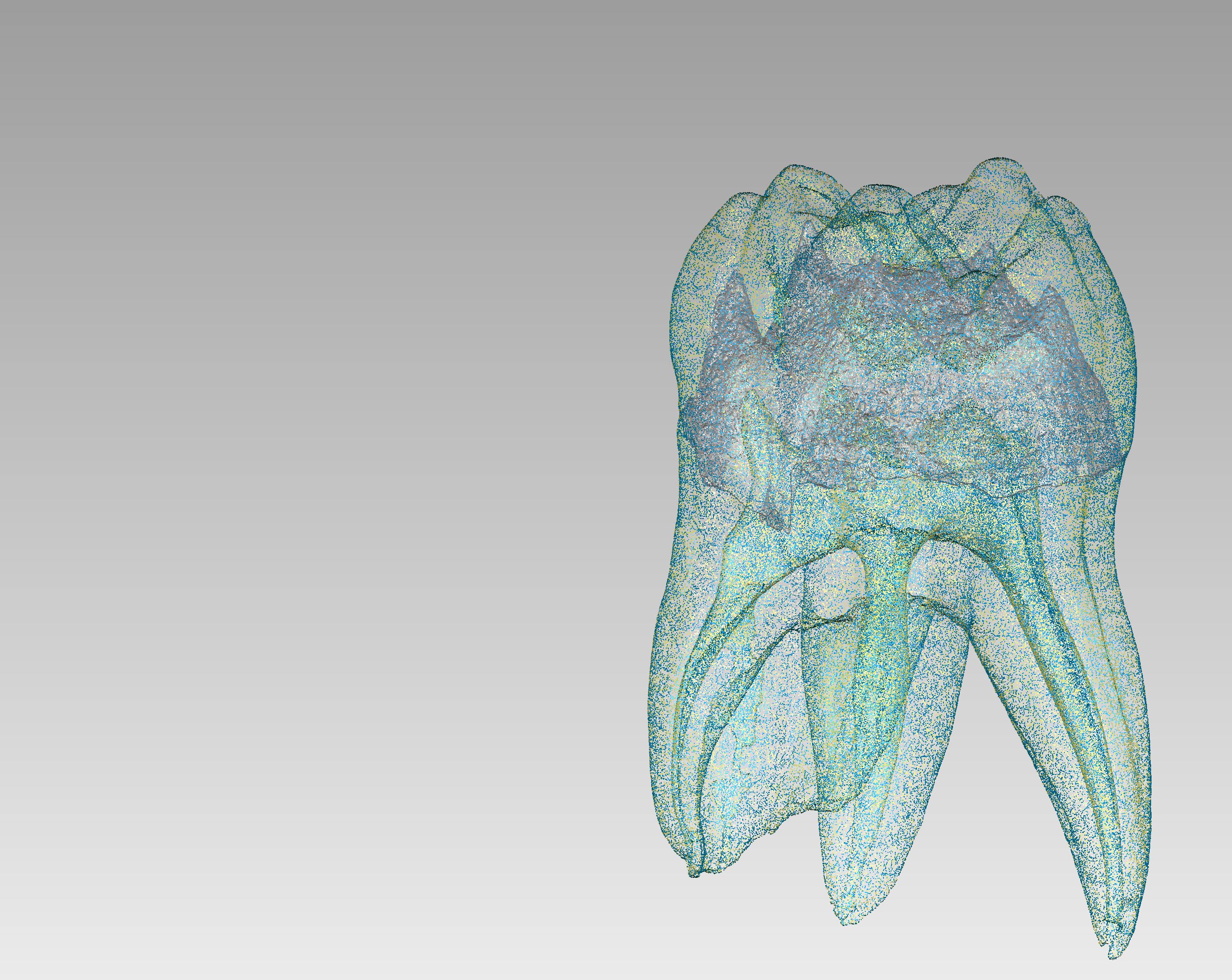 上顎第一大臼齒 Micro-CT 3D列印