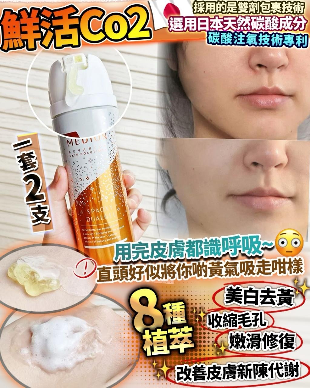 (2支)鮮活Co2 R581（1-2 星期寄出）