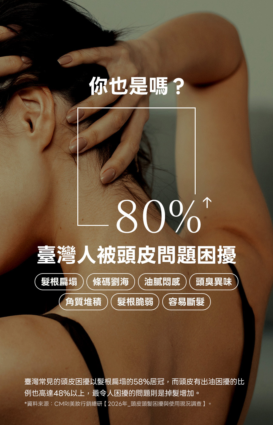 臺灣頭皮問題
