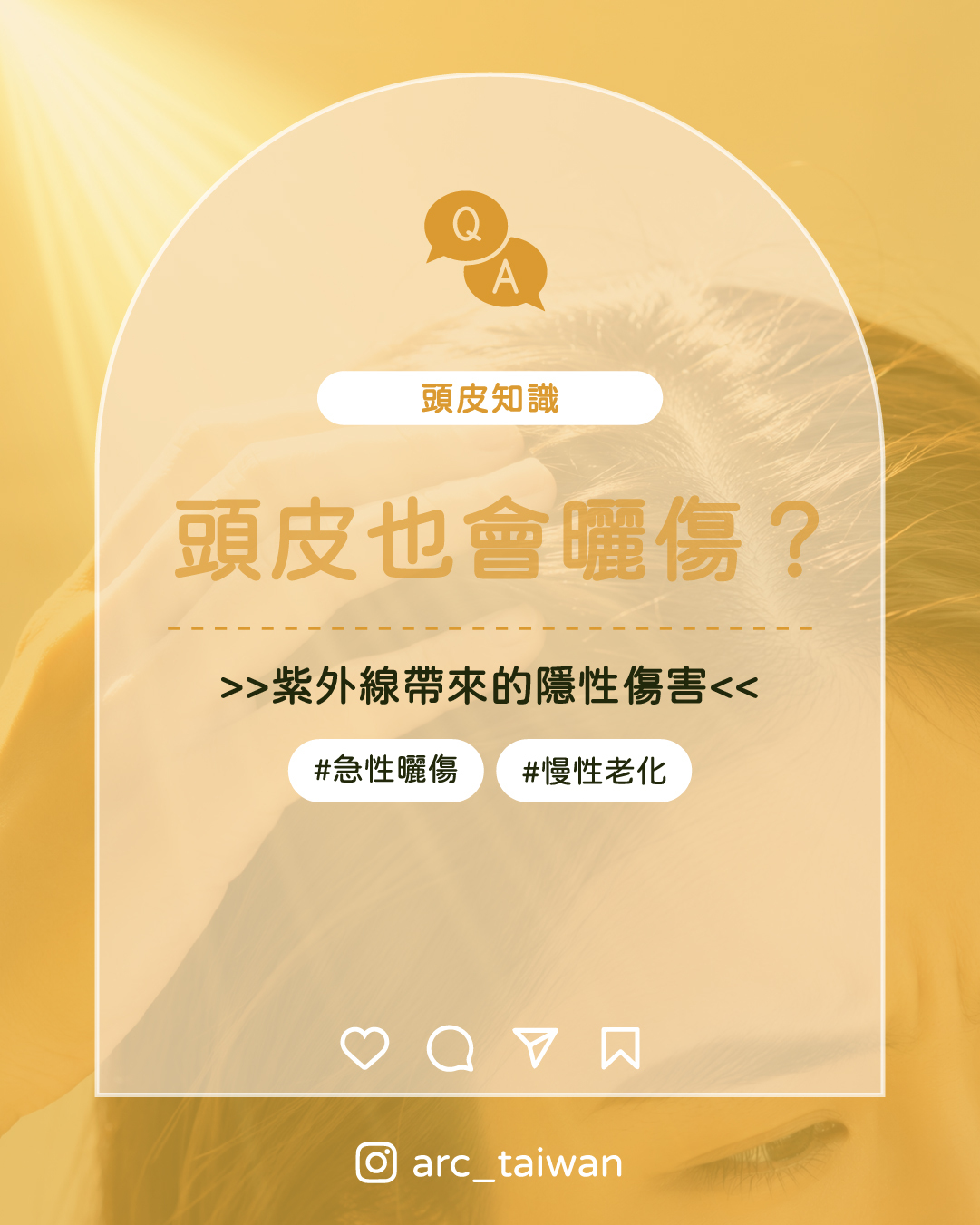 頭皮也會曬傷嗎?紫外線對頭皮的影響與夏季修護方法|弧形商城