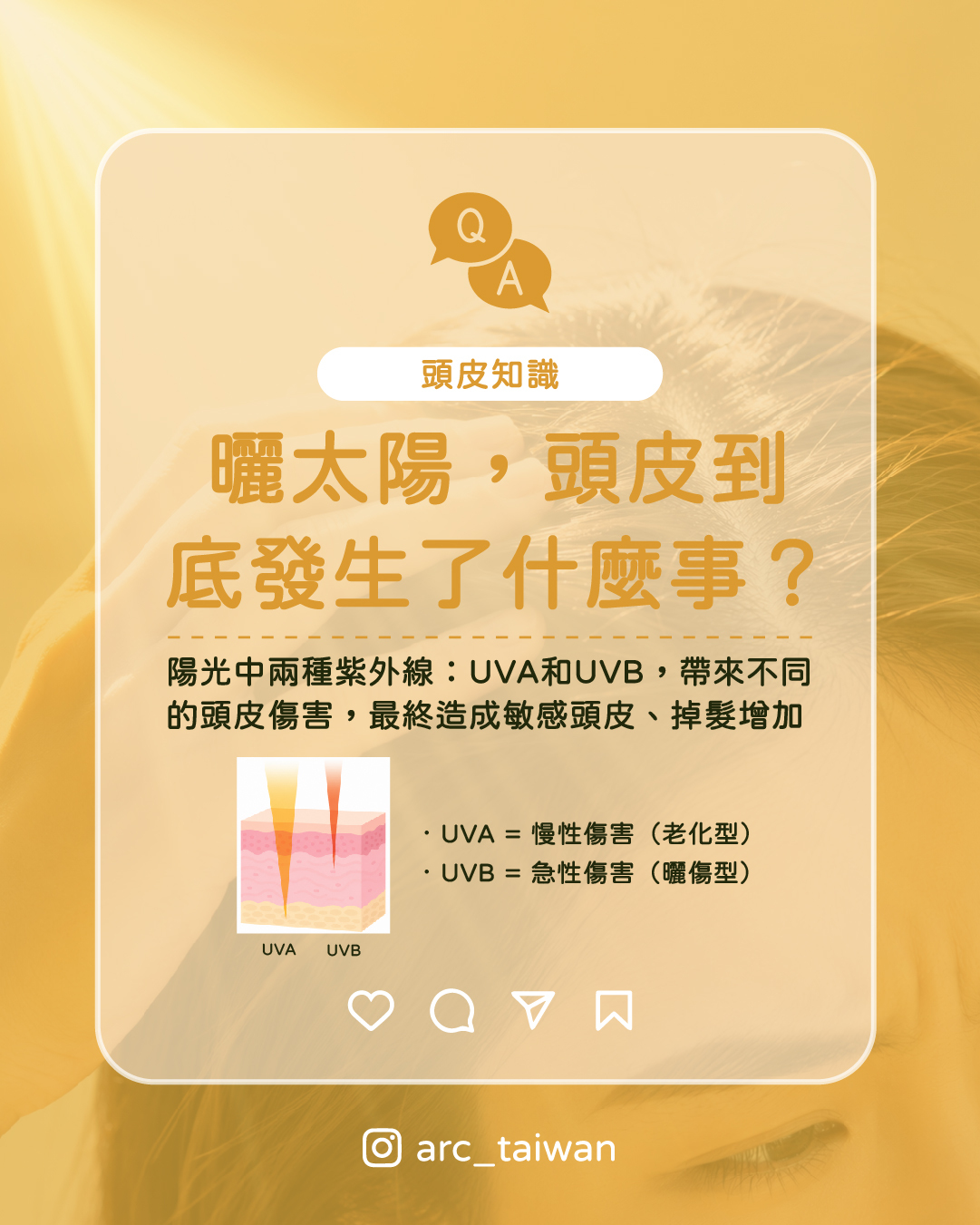 曬太陽,頭皮到底發生了什麼事?陽光中有兩種紫外線,分別以不同方式傷害頭皮: UVA|傷在深處,感覺不到穿透力強,悄悄破壞頭皮深層結構, 毛囊慢慢變弱,頭髮越長越細、越來越少。UVB|傷在表面,立即有感 直接灼傷頭皮表層, 出現泛紅、脫皮、搔癢等明顯不適。 簡單說: UVA 是慢性傷害,UVB 是急性刺激, 兩個加在一起,就是夏天頭皮變敏感、掉髮變多的主因。