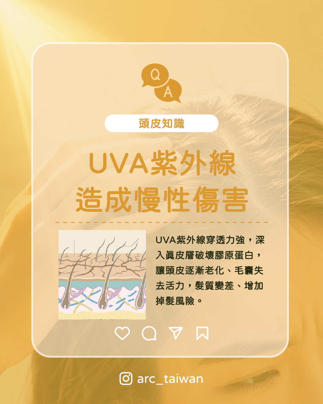 UVA|傷在深處,感覺不到 穿透力強,悄悄破壞頭皮深層結構, 毛囊慢慢變弱,頭髮越長越細、越來越少。