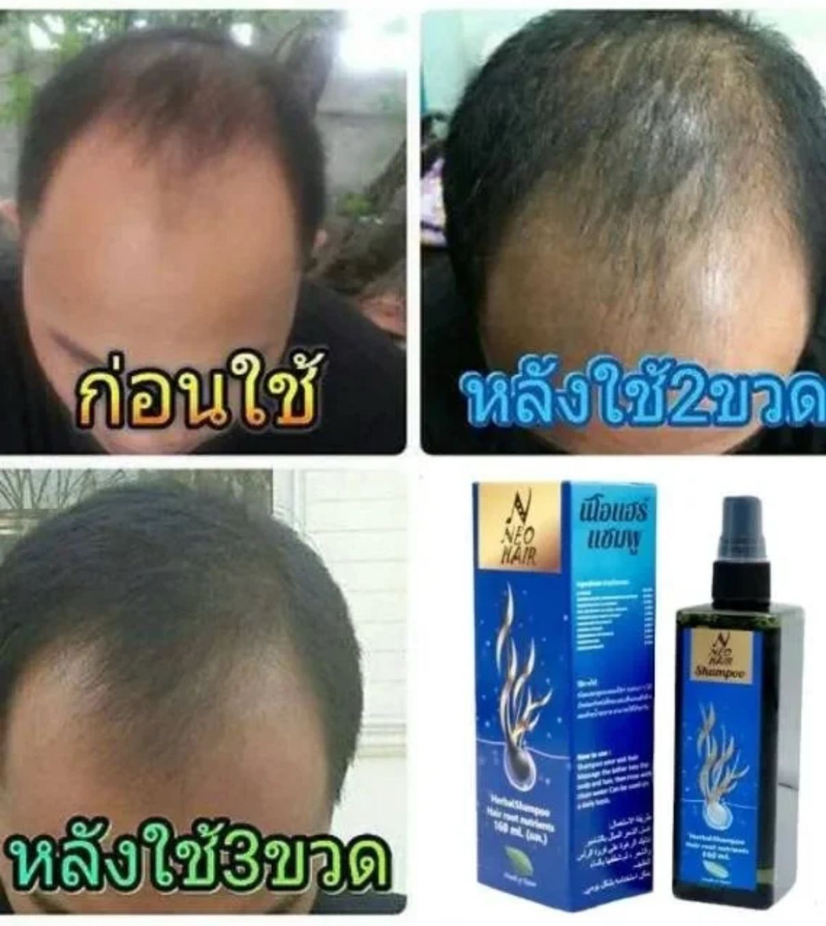 泰國神級生髮權威 Neo Hair 草本修護防脫生髮洗頭水160ml