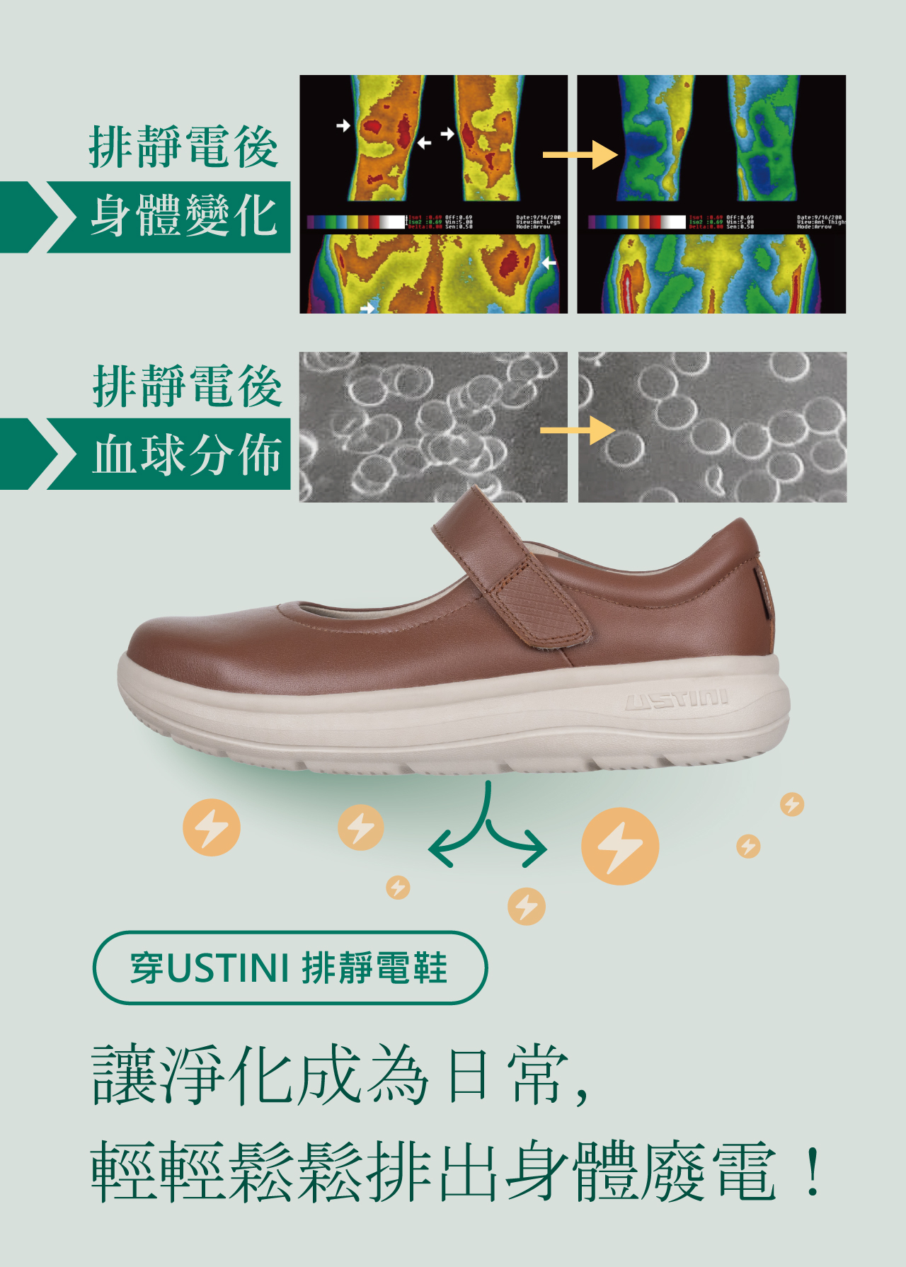 USTINI 我挺你健康鞋 瑪莉珍補補接地鞋 排靜電前後身體變化