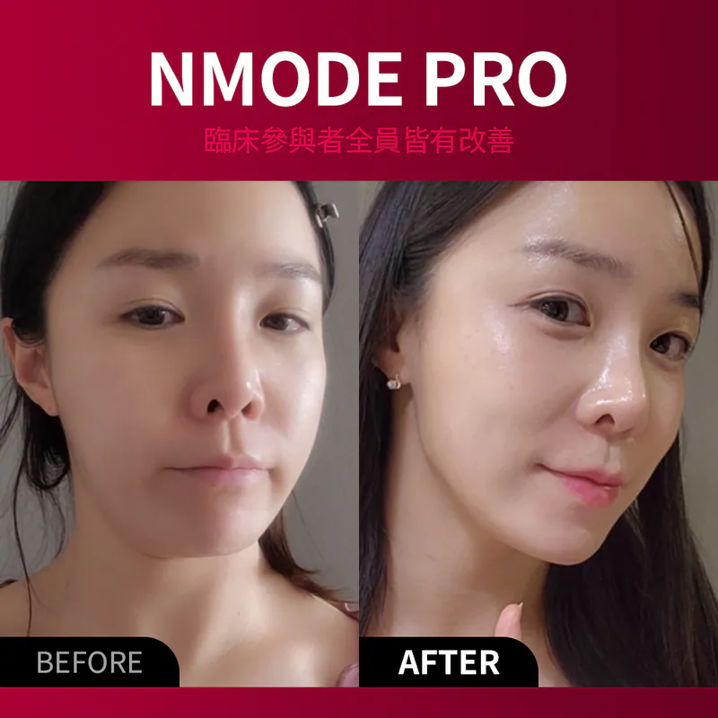 BEAUND NMODE PRO — 高端居家面部美容儀