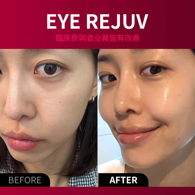 BEAUND Eye Rejuv