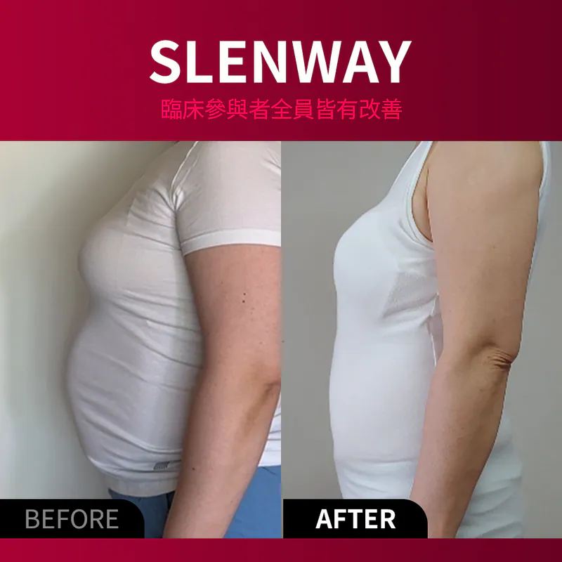 BEAUND SLENWAY — EMS+NIR 腹部護理腰帶