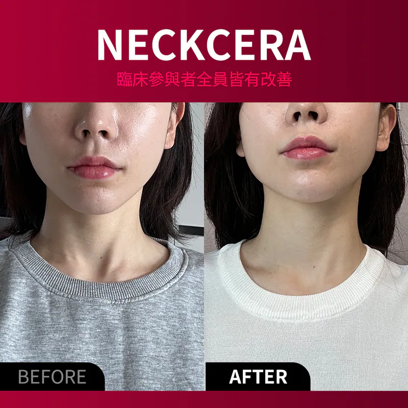 BEAUND NECKCERA — 納米EMS頸部提拉儀