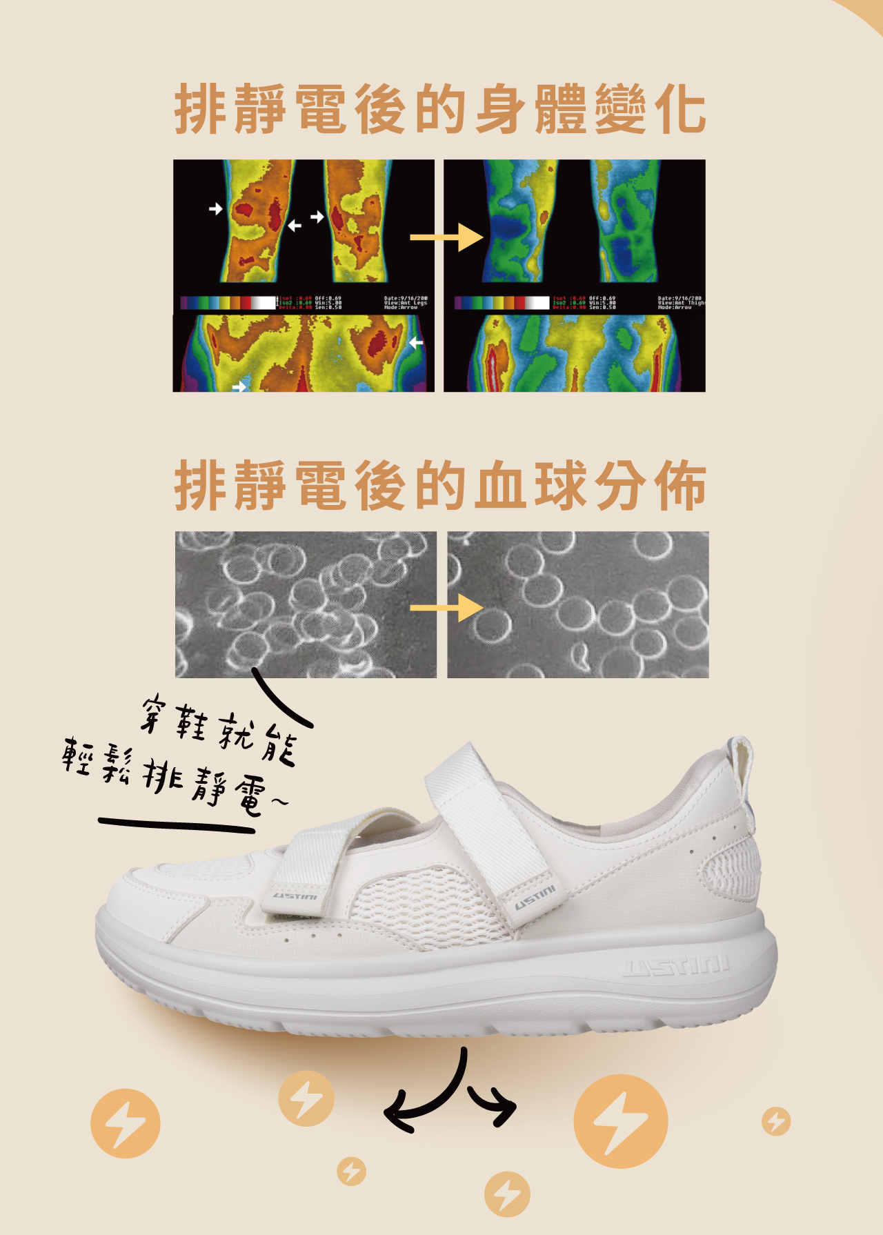 USTINI 我挺你健康鞋 軟法瑪莉珍拉帶接地鞋 自由基會使細胞老化