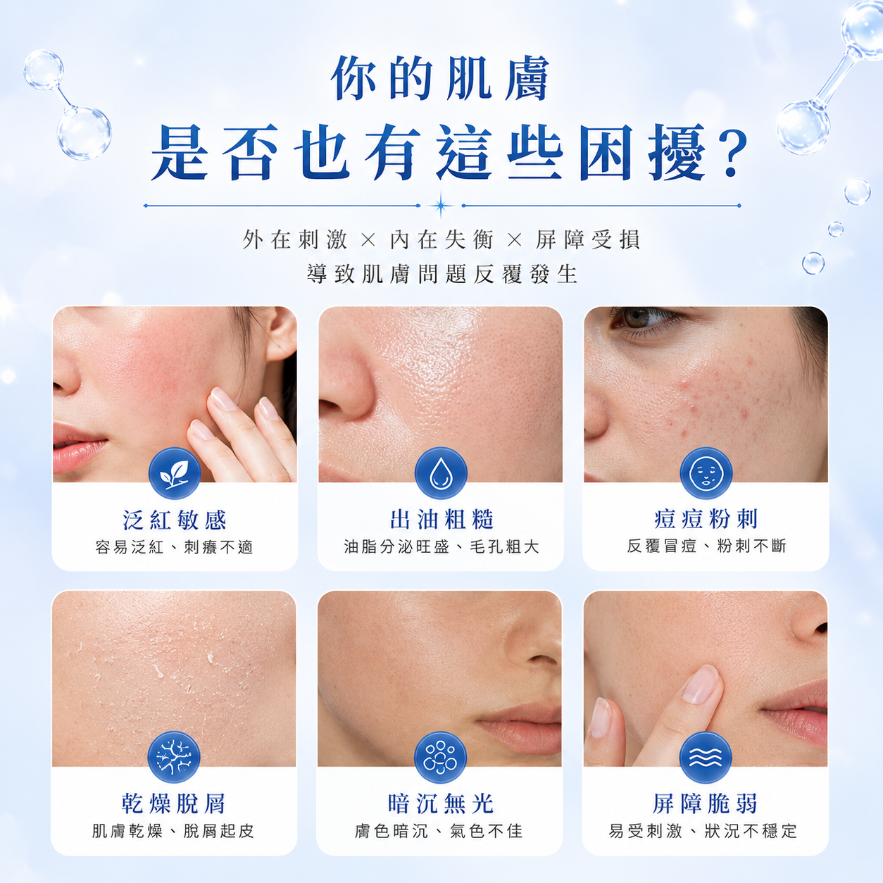 積雪草舒敏淨膚課程