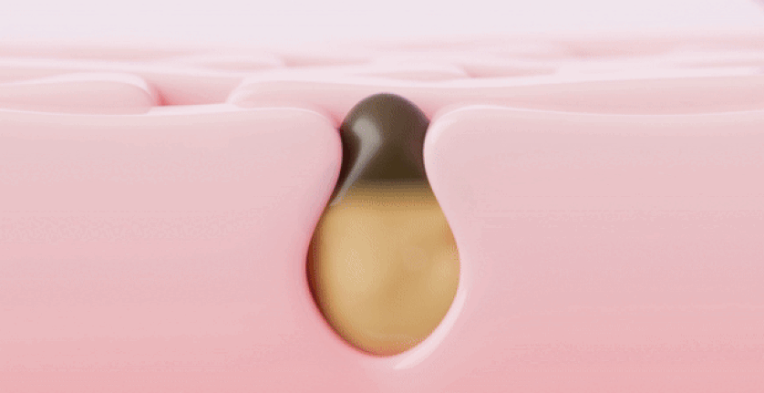 GIF03
