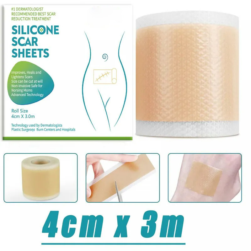 Silicone scar removal tablets waterproof and lightening New wounds, old wounds stretch mark scar patch Skin scar repair roll Self-adhesive scar tape caesarean section scar patch scar removal patch parallel import (3mx4 cm)