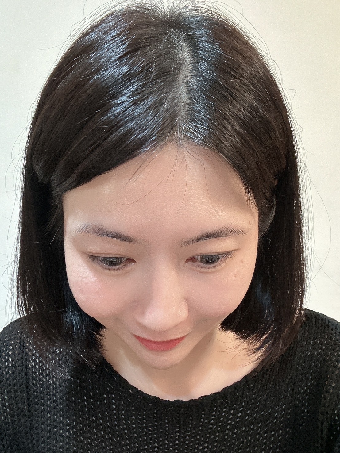 髮際分線